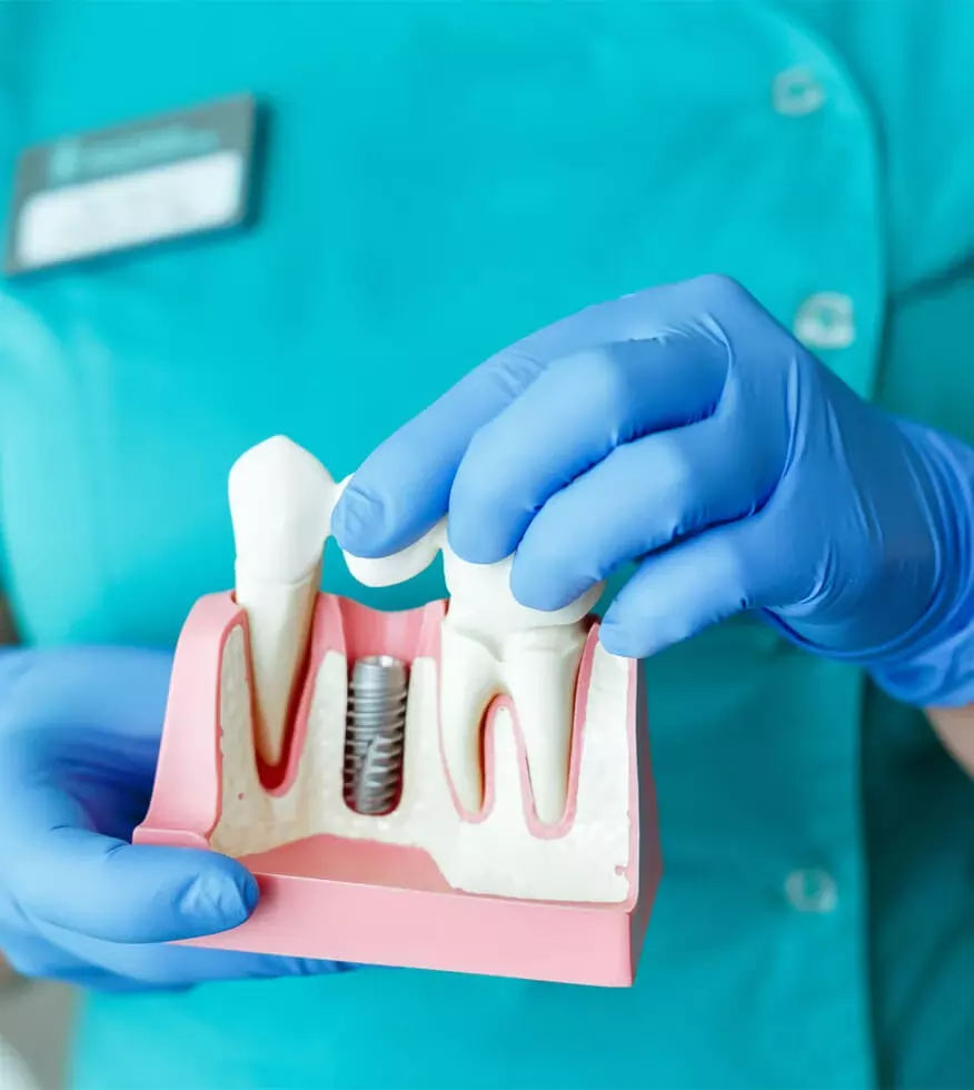 Implant dentaire Tunisie