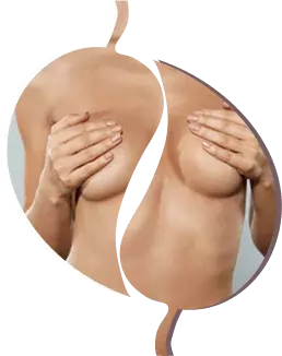 chirurgie seins