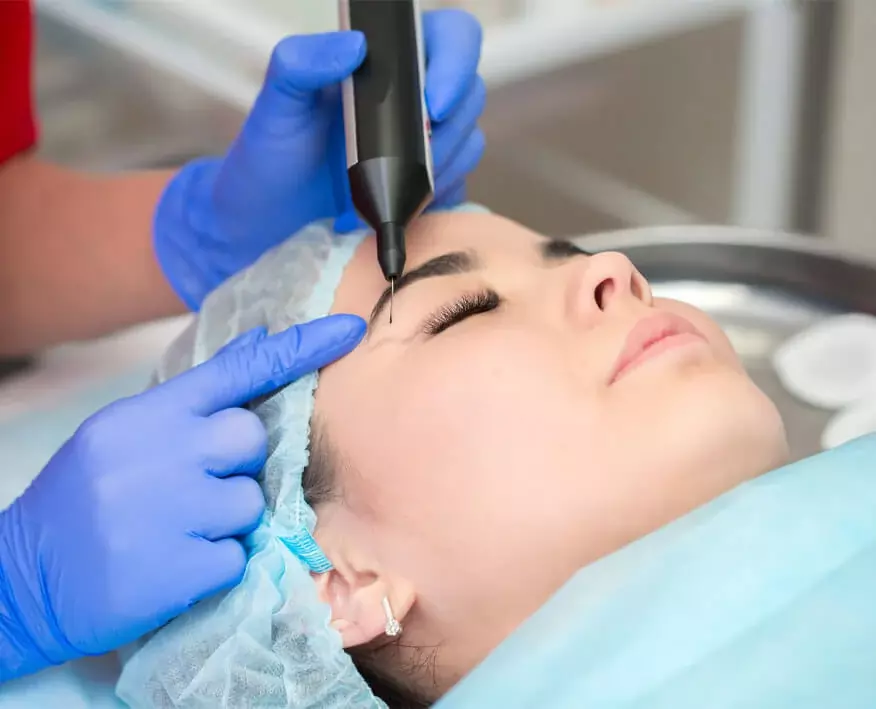 Blépharoplastie laser en Tunisie