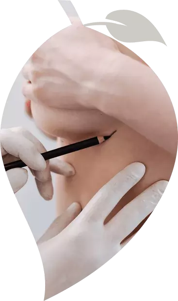 Résultat augmentation mammaire par implants ronds ou anatomiques