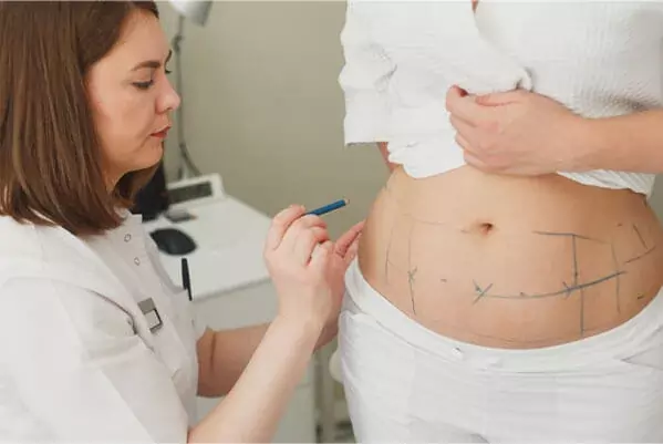 Chirurgie de l'obésité