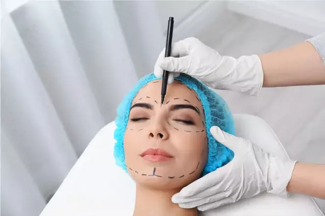 Chirurgie du visage